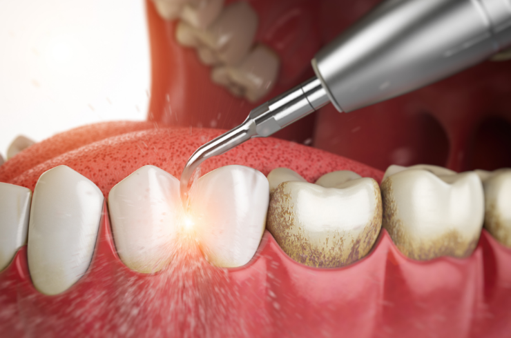 Periodontics